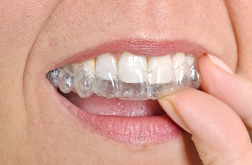 Invisalign protector for teeth